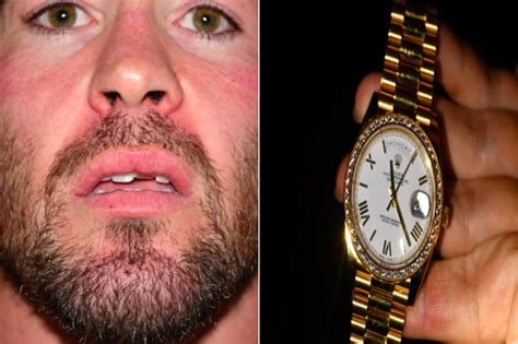 colby covington fake rolex|Colby Covington injuries from Jorge Masvidal attack seen in photos.